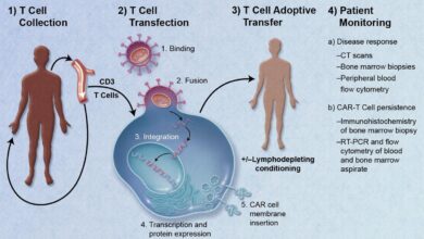 Understanding the potential of CAR-T therapy in autoimmune disease treatment