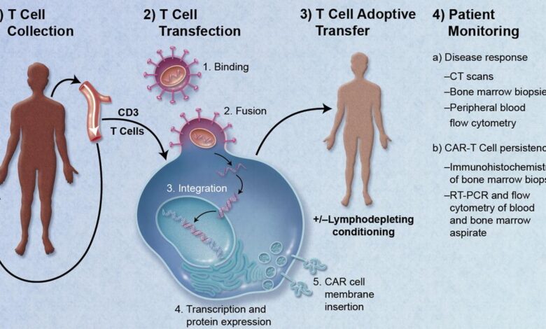 Understanding the potential of CAR-T therapy in autoimmune disease treatment