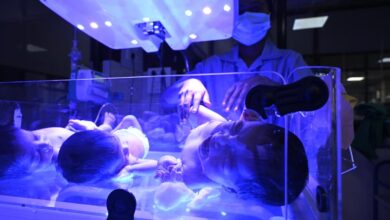 Umbilical cord blood may hold clues for a child’s risk of developing Type 1 diabetes