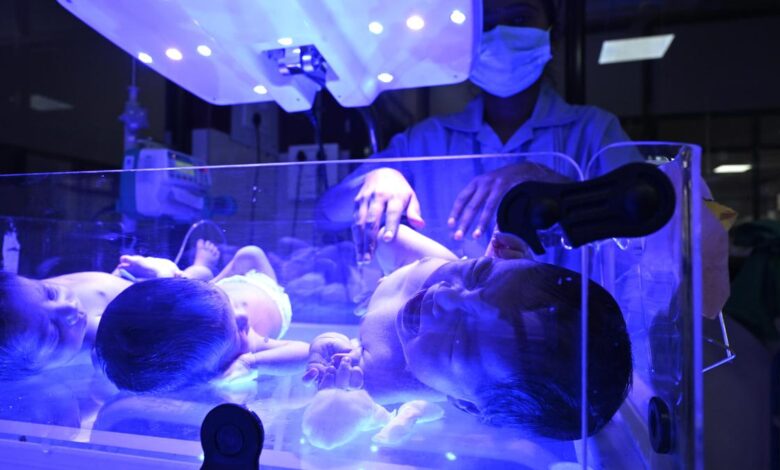 Umbilical cord blood may hold clues for a child’s risk of developing Type 1 diabetes