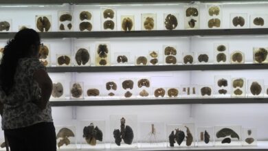 IISc’s Centre for Brain Research launches ₹2 crore AI challenge for early detection of cognitive decline