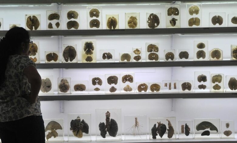 IISc’s Centre for Brain Research launches ₹2 crore AI challenge for early detection of cognitive decline